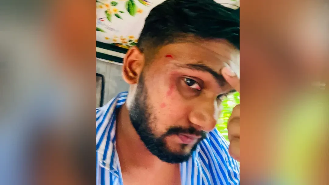 গাঁজা-বাবা কী তোর বাপের টাকায় খাই’ বলেই ছাত্রদল সভাপতিকে মারধর